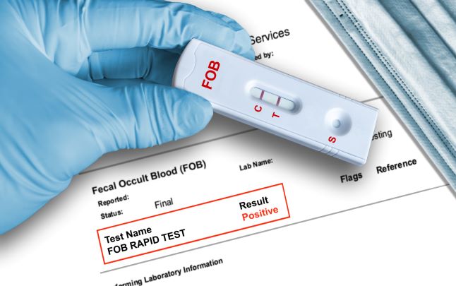 Finding cancer with an at-home test